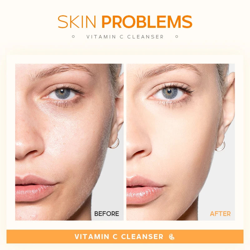 LAIKOU Vitamin C Cleanser